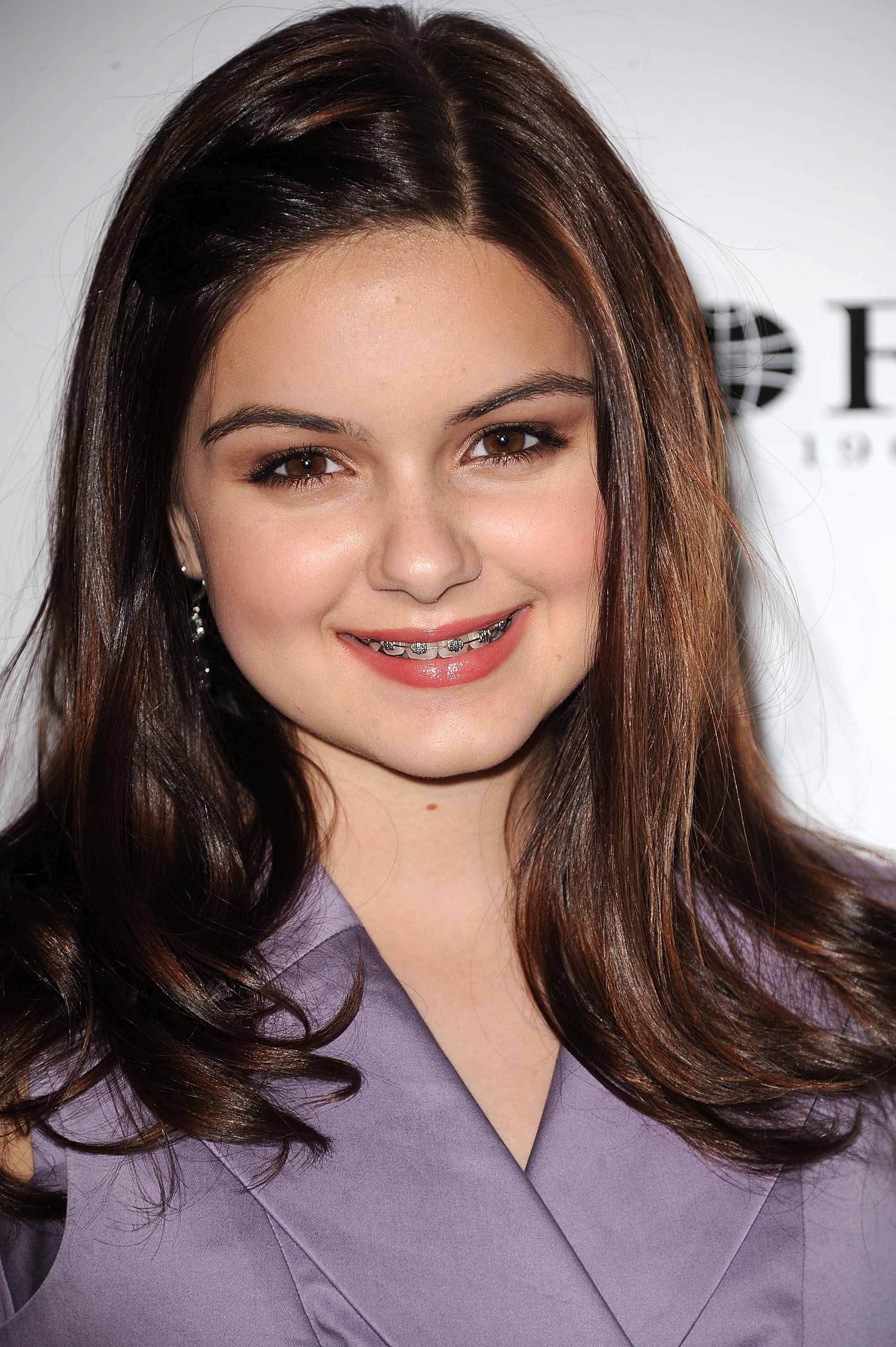 10 Celebrities You Never Knew Had Braces 2026