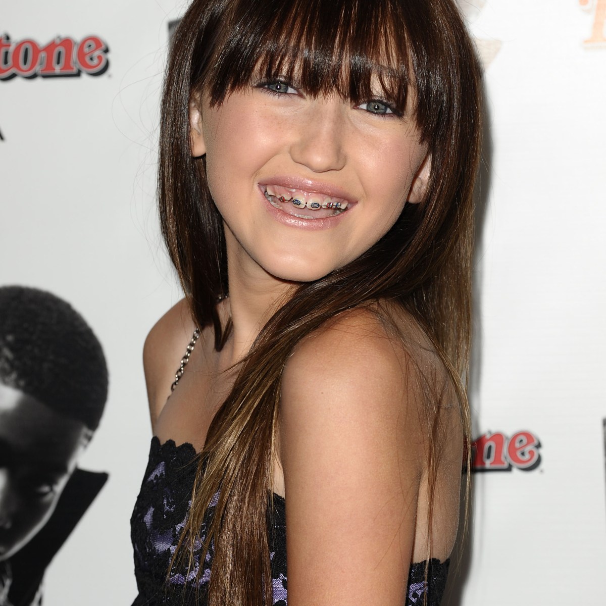 10 Celebrities You Never Knew Had Braces