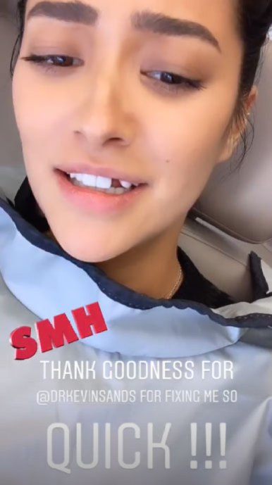 Watch: Shay Mitchell's Tooth Falls Out After Eating Bagel | J-14