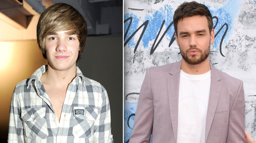 One Direction Transformation Then And Now Photos Of Band 