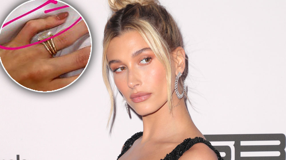 Hailey Baldwin Genetic Condition Ectrodactyly Crooked Pinkies J 14